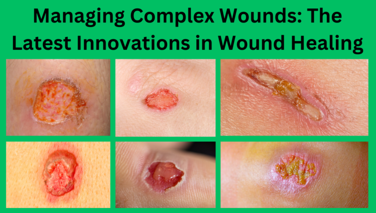 Complex Repair Managing Complex Wounds: The Innovations in Wound Healing