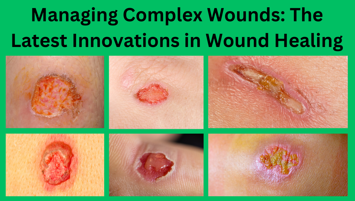 Managing-Complex-Wounds-The-Latest-Innovations-in-Wound-Healing